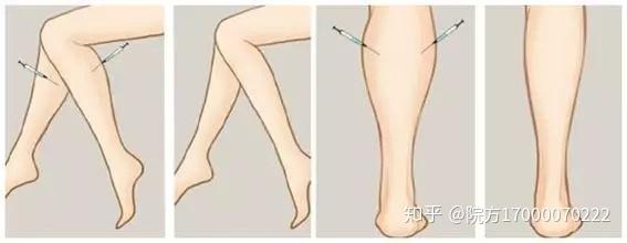 夏日还不够sexy或许是你需要一支瘦腿针