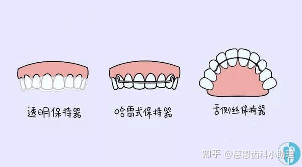 深圳牙齿矫正科普丨保持器的作用你真的知道吗?