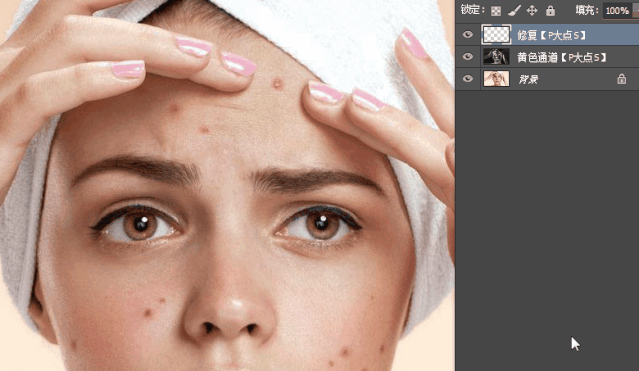 ps去除脸上的痘痘-庞姿姿