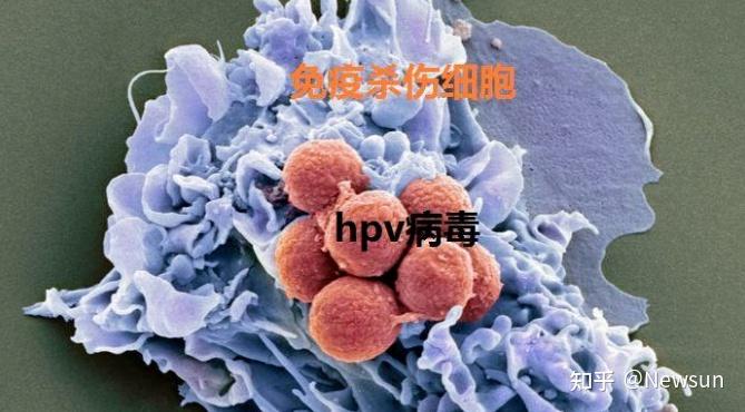 现实生活中,hpv 病毒非常常见,即使常规的性生活也有感染