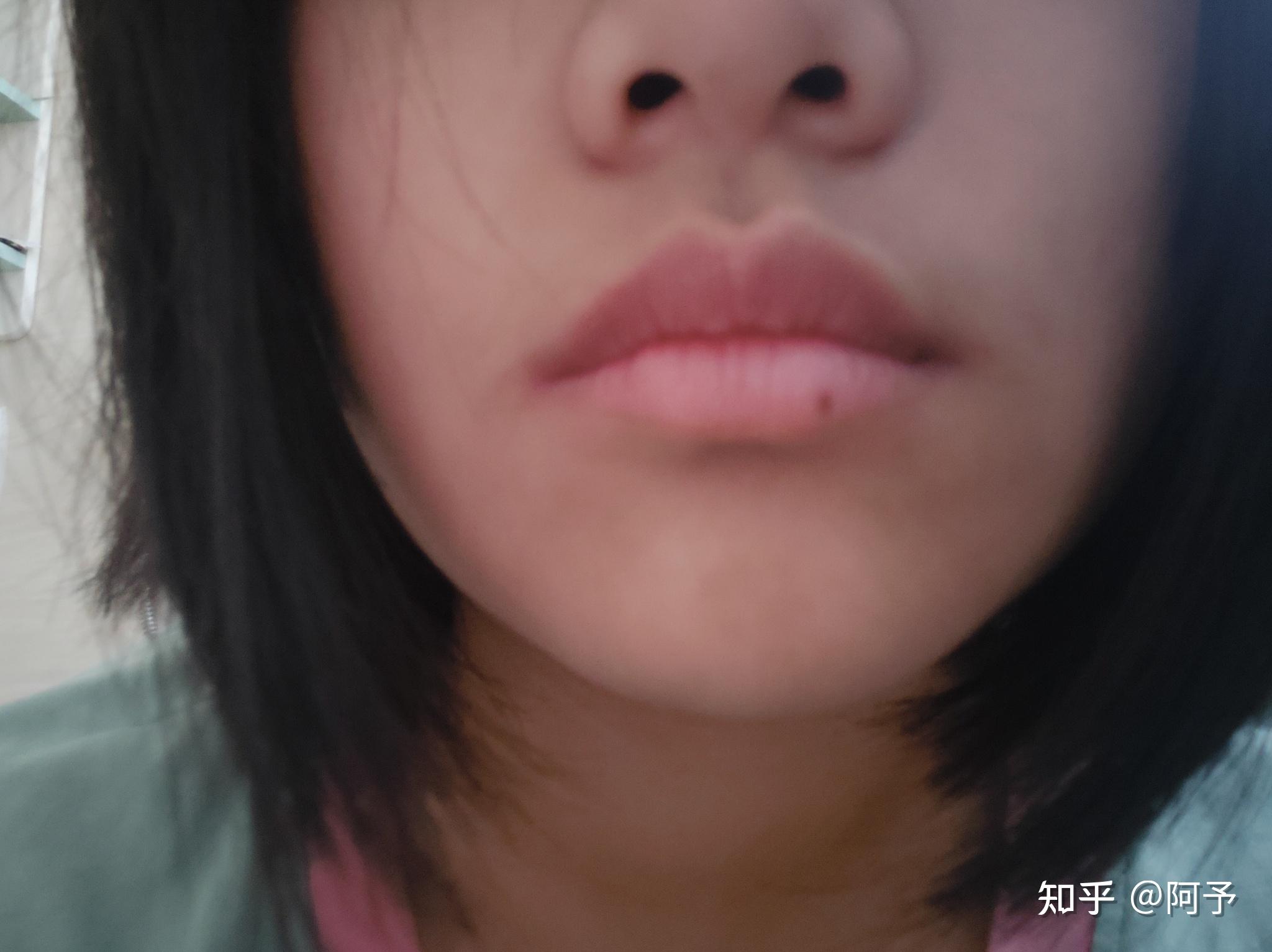 有没有下嘴唇有痣的小姐姐