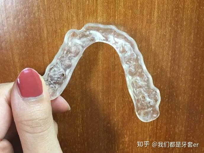 牙齿很齐笑起来露牙龈可以带牙套解决不露龈么