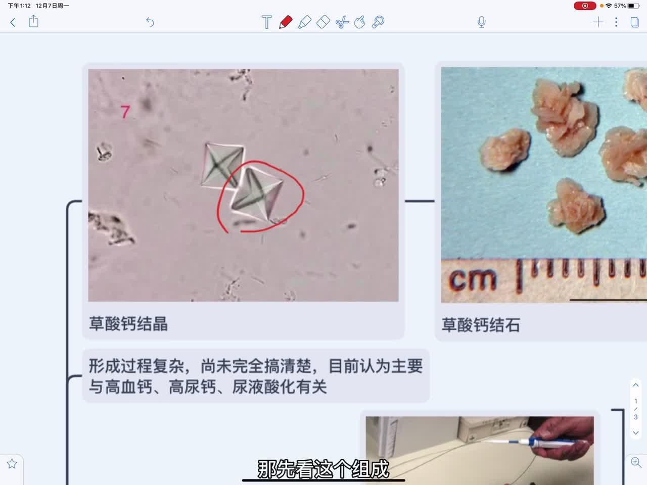 猫慢性肾病(ckd)分期