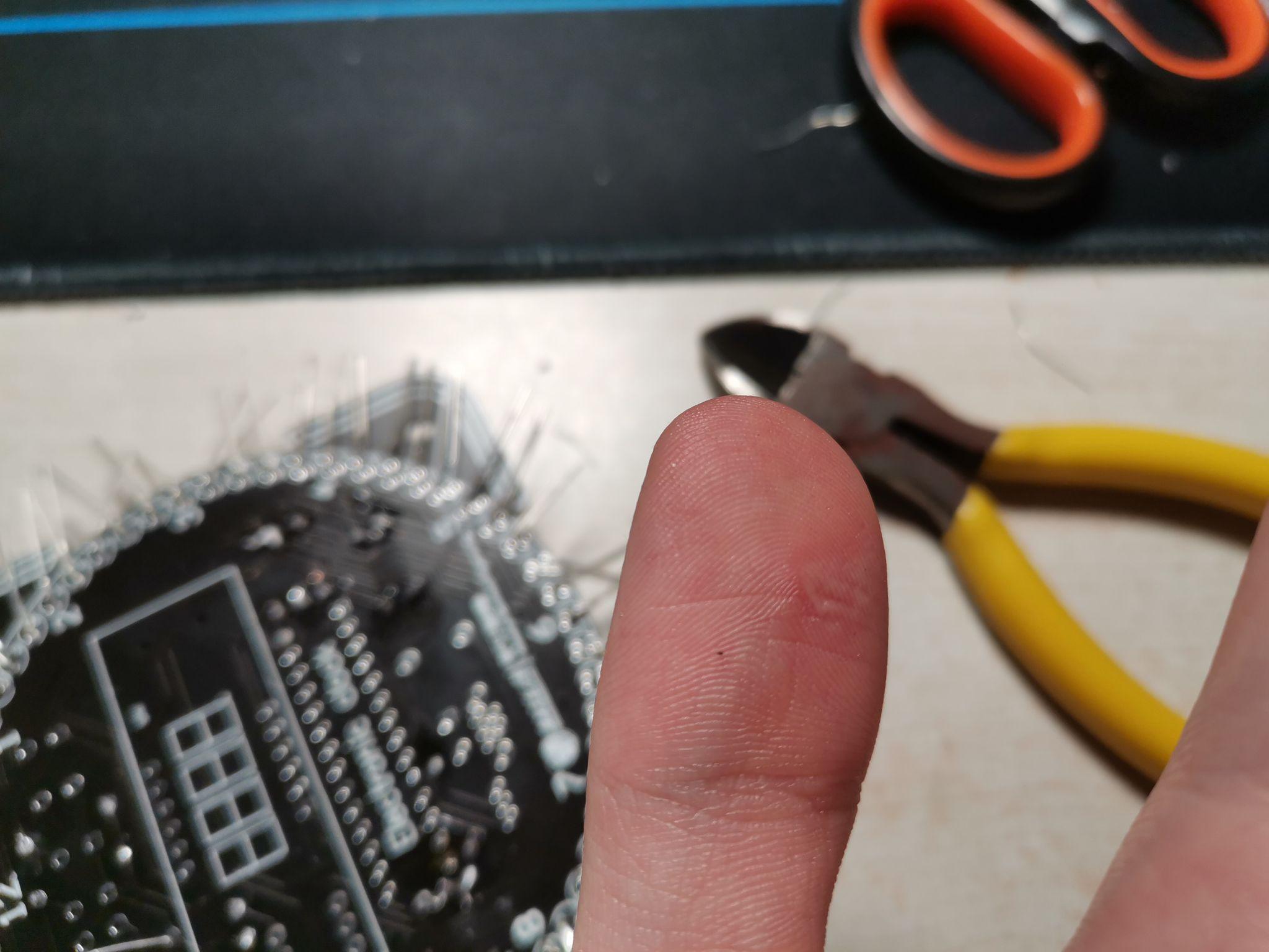 被电烙铁烫伤是一种什么样的体验怎么处理不易留疤