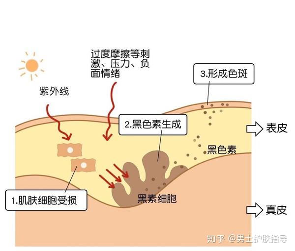 紫外线导致黑色素生成全过程