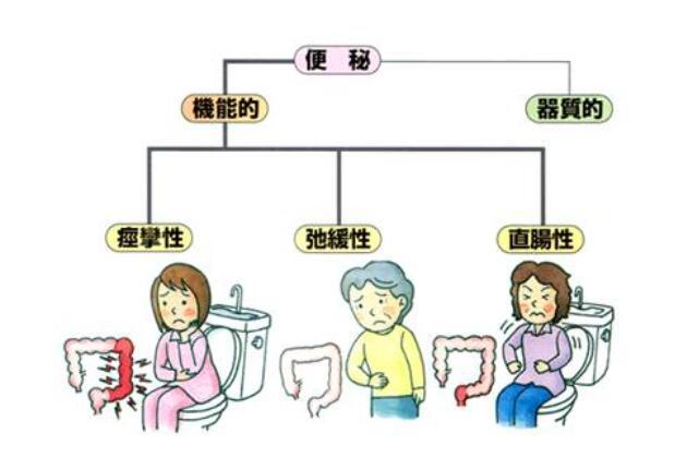 老年人便秘完全解决手册 科学而系统的帮老人摆脱便秘