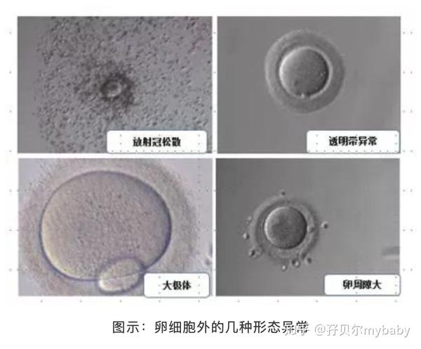 我的卵子是否完美