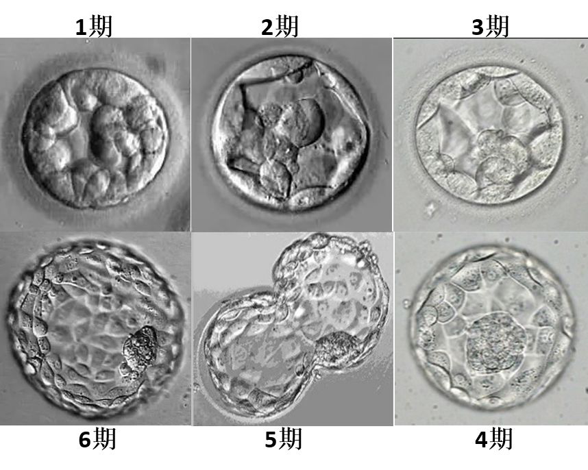 试管婴儿囊胚等级如何划分呢