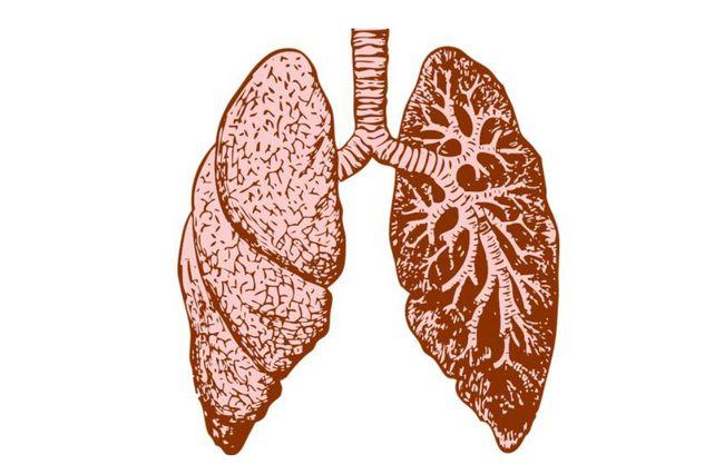 尼达尼布维加特治疗肺纤维化的效果及副作用简介