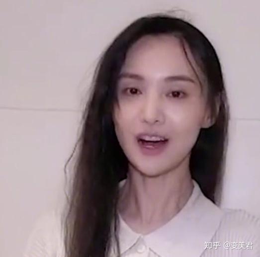 郑爽整容整了哪里 知乎