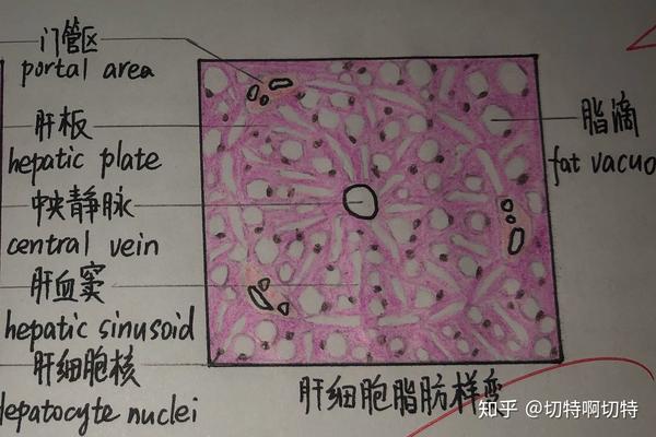 肉芽组织 由新生毛细血管与成纤维细胞组成