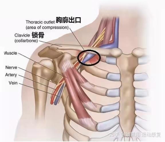 胸廓出口综合征常被误认为颈椎病的伪装者