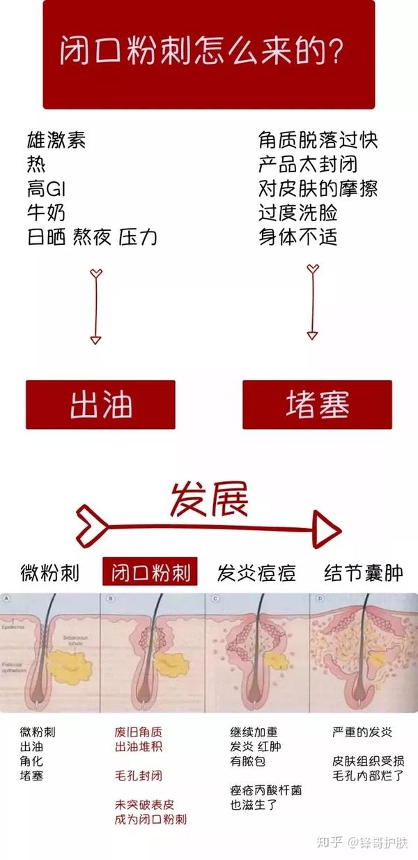 问题二:发脓的痘痘怎么办?