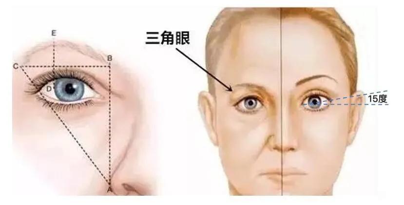 为什么要做眼综合?