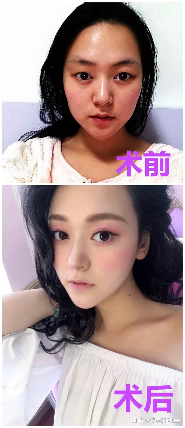 内眼角尖而深邃,眼尾略弯向上翘,眼神迷离,笑的时候像月牙儿,看起来