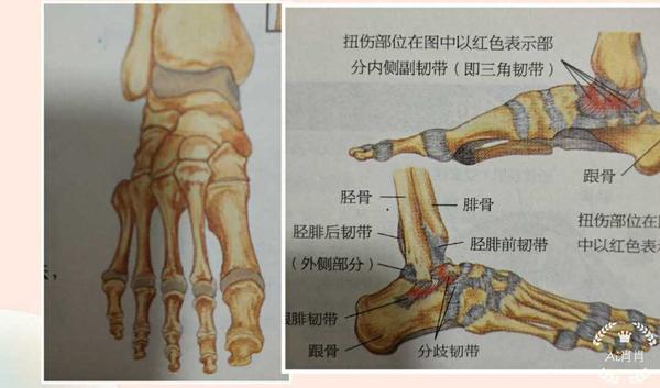 崴脚与踝关节疼痛原因和康复原理