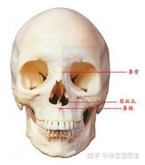鼻基底凹陷主要是由于骨骼发育不足,以及随着年龄增加梨状孔增大引起