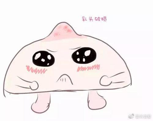 雷氏普爱:乳头皲裂痛到难以继续哺乳,宝妈该何去何从?