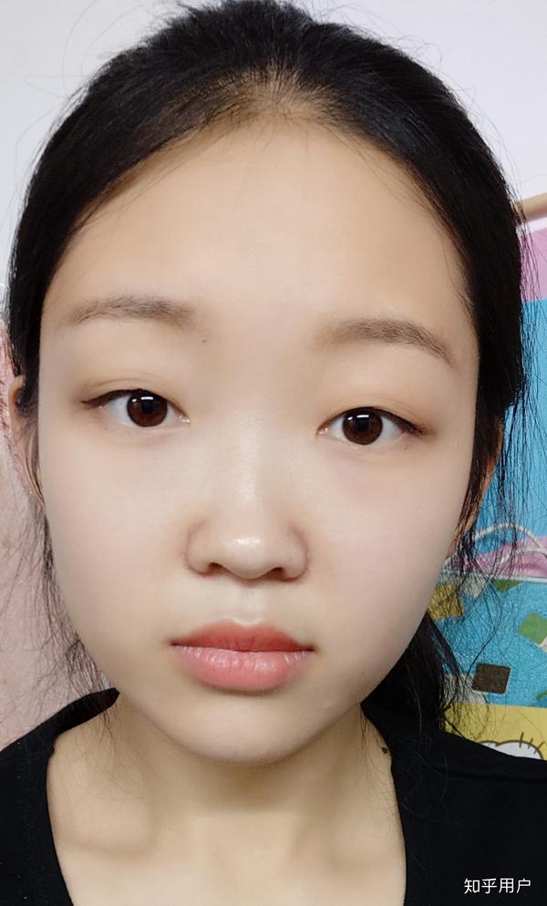 有的人单眼皮但眼睛大应该不会显得无神.