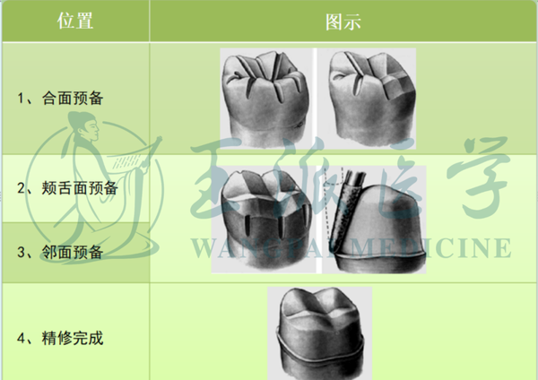 口腔执医技能考试牙体预备全冠的预备