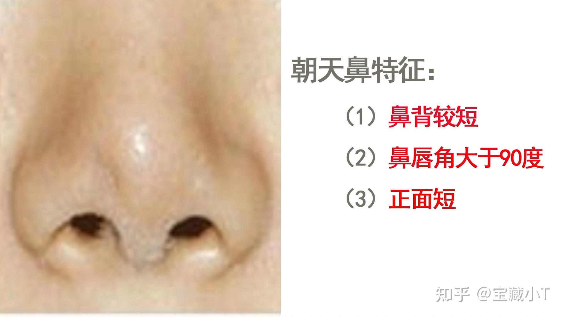 最关键的特点就是从正面可以看到鼻孔,有点像猪鼻子.
