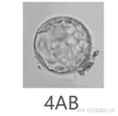 一分钟了解,试管婴儿囊胚的等级划分!