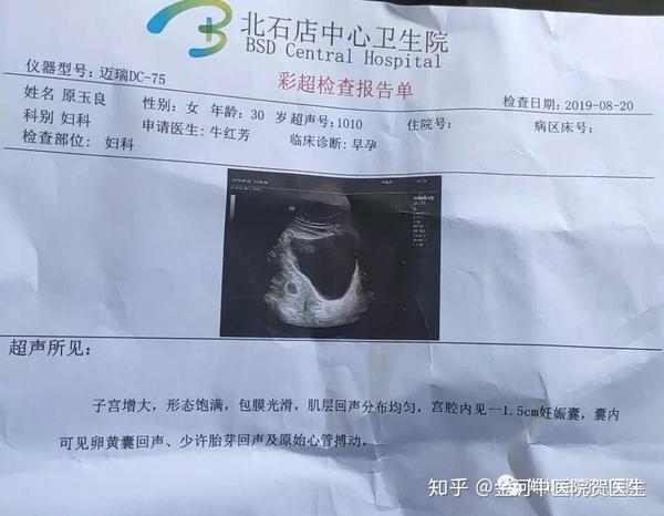 输卵管结核你知道吗?