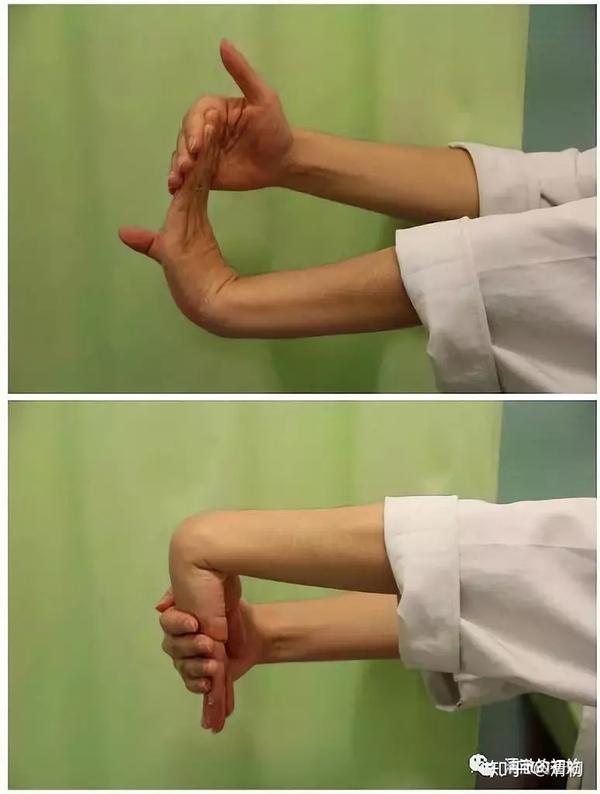 运动康复 可以做一些腕部的屈伸旋转动作,动作幅度维持在可承受范围