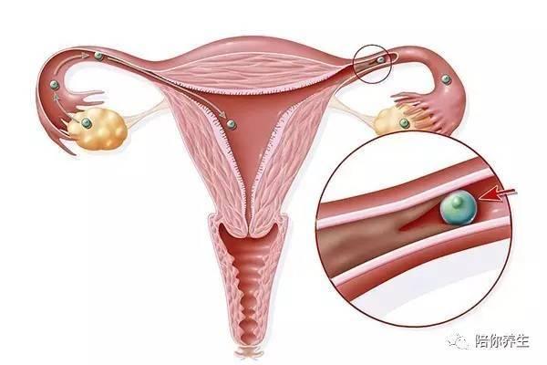于萍讲孕育输卵管性不孕诊断与治疗的策略
