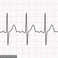 心电图各波段的命名和定义你掌握了吗