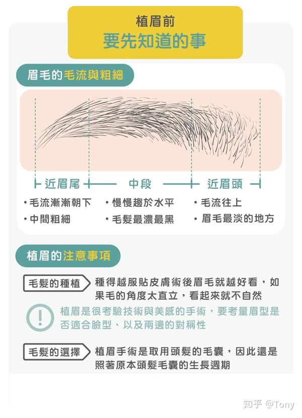 关于植眉手术的最全帖