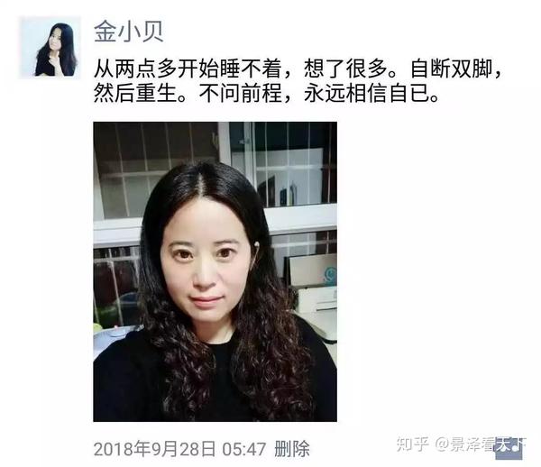 金小贝 zhuanlan.zhihu.com