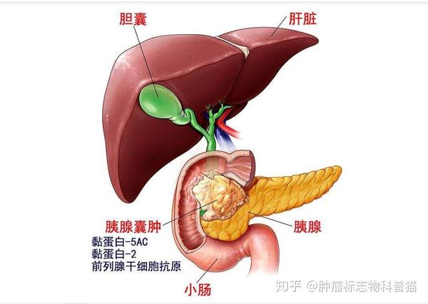 胰腺癌的检查手段有哪些? 肿瘤标志物 影像学检查