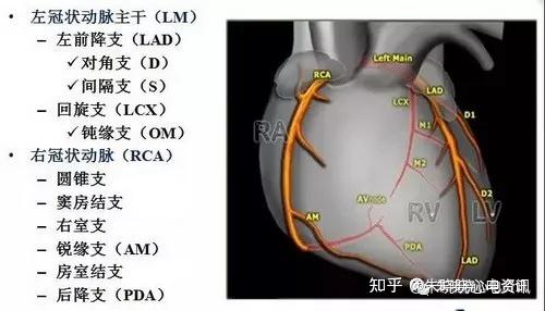 第1招:了解冠脉解剖结构及供血范围