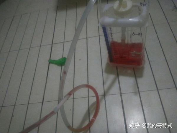 气胸有什么危害?