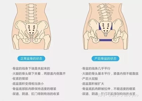 每个产妇都要做"盆骨修复"?背后的真相让人震惊!