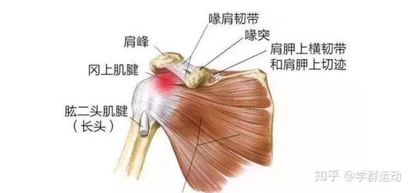 肩弓反复撞击,导致肩峰下滑囊炎症,肩袖组织退变甚至撕裂引起肩部疼痛