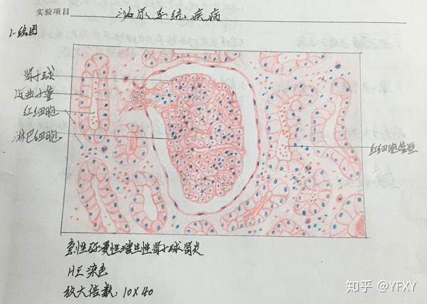 病理学红蓝铅笔绘图