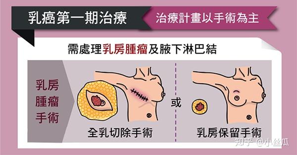 香港联合肿瘤中心临床肿瘤科医生治疗乳癌为何以手术优先