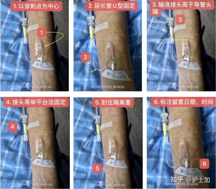 参考文献:徐琴鸿,刘丽萍,主编.护理技能操作流程与评分标准.