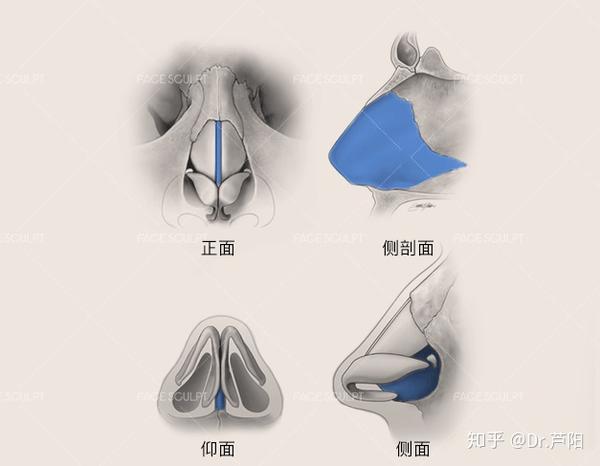 塌鼻如何变高?从「鼻部户型」开始理解