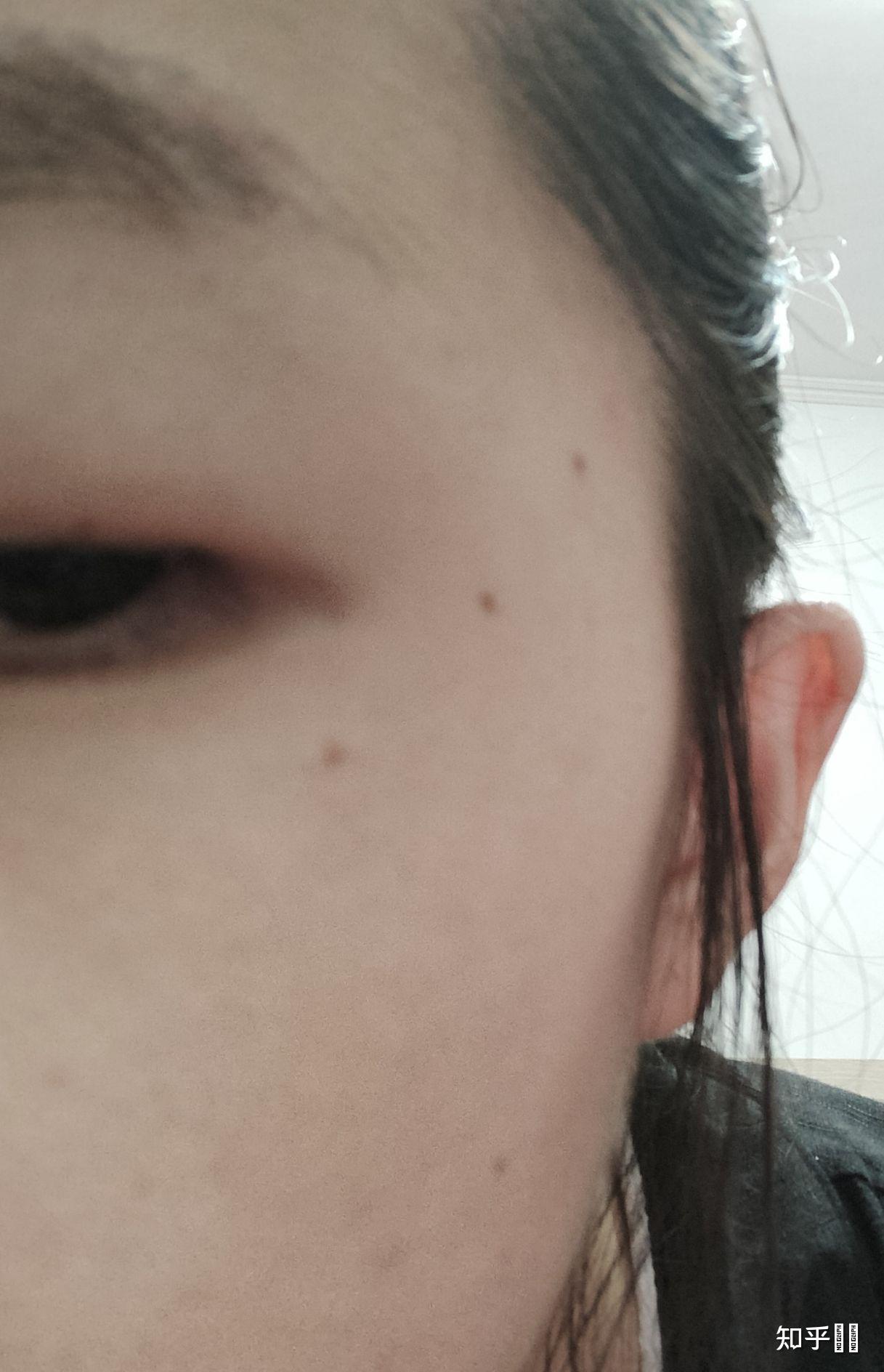 有没有人可以指点一下呀三颗痣连成一条线是怎么样阿