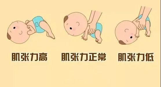 泸州儿保科医生告诉你:宝宝肌张力低下的原因和表现是