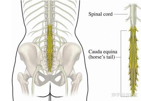 什么样的情况属于马尾神经遭受到压迫呢?