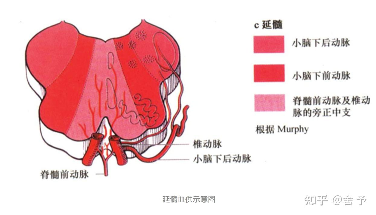 巧记Wallenberg综合征 知乎