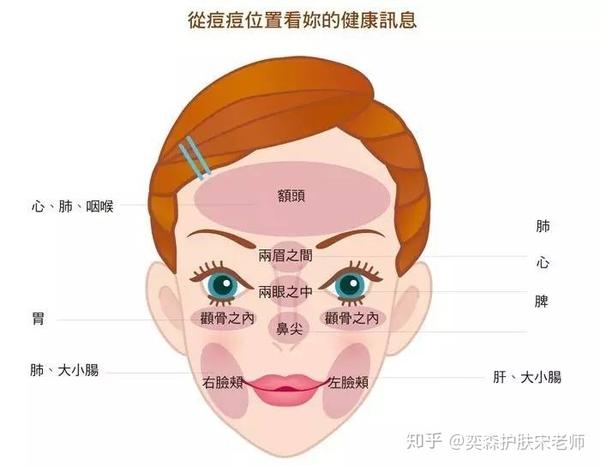 额头部位的痘痘在中医看来属于心火旺盛,血液循环有问题.