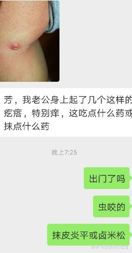 丘疹性荨麻疹虫咬皮炎案例分享