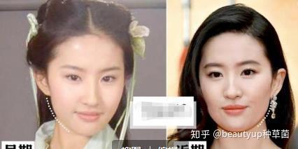 20女明星都怕的颜值杀手到底要怎么预防发腮以及视觉衰老