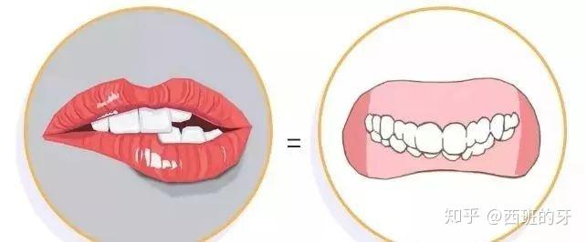 【西班的牙】|牙齿早期干预