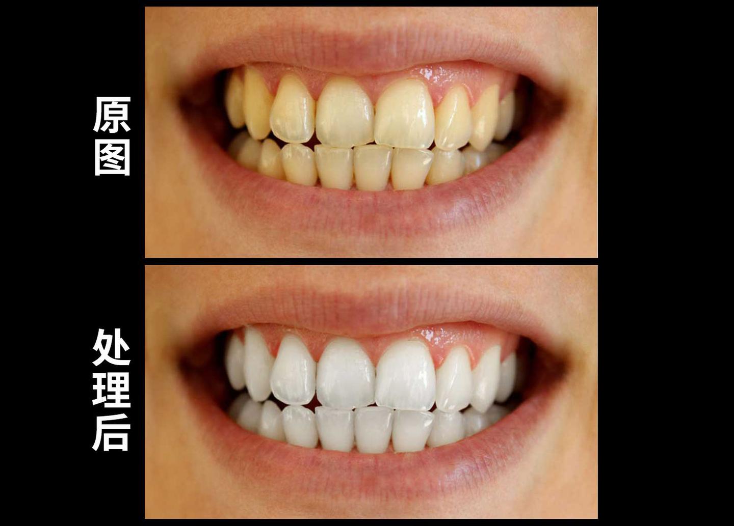 ps教程:牙齿黄不敢笑?教你一招变白